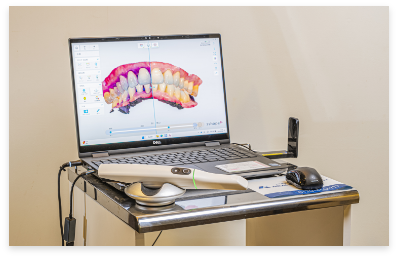 口腔内スキャナー