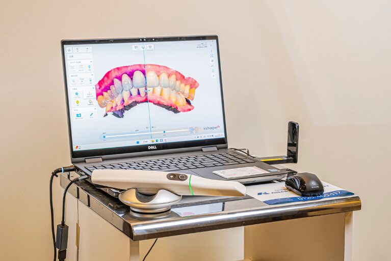 口腔内スキャナー